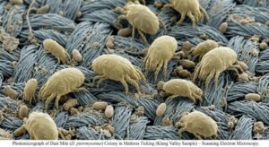 dust mite colony under microscope found in klang valley condo mattress fabric due to high humidity