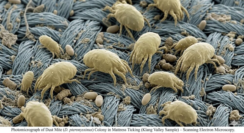 dust mite colony under microscope found in klang valley condo mattress fabric due to high humidity